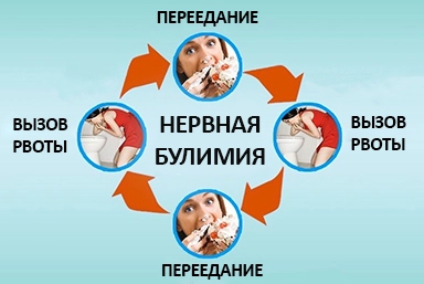 Лечение булимии в Дедовске